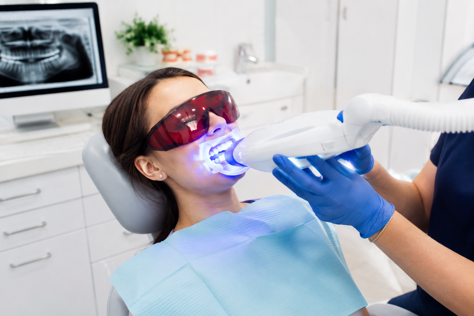 Professional supervised teeth whitening treatment with protective eyewear and whitening gel application showing modern dental equipment